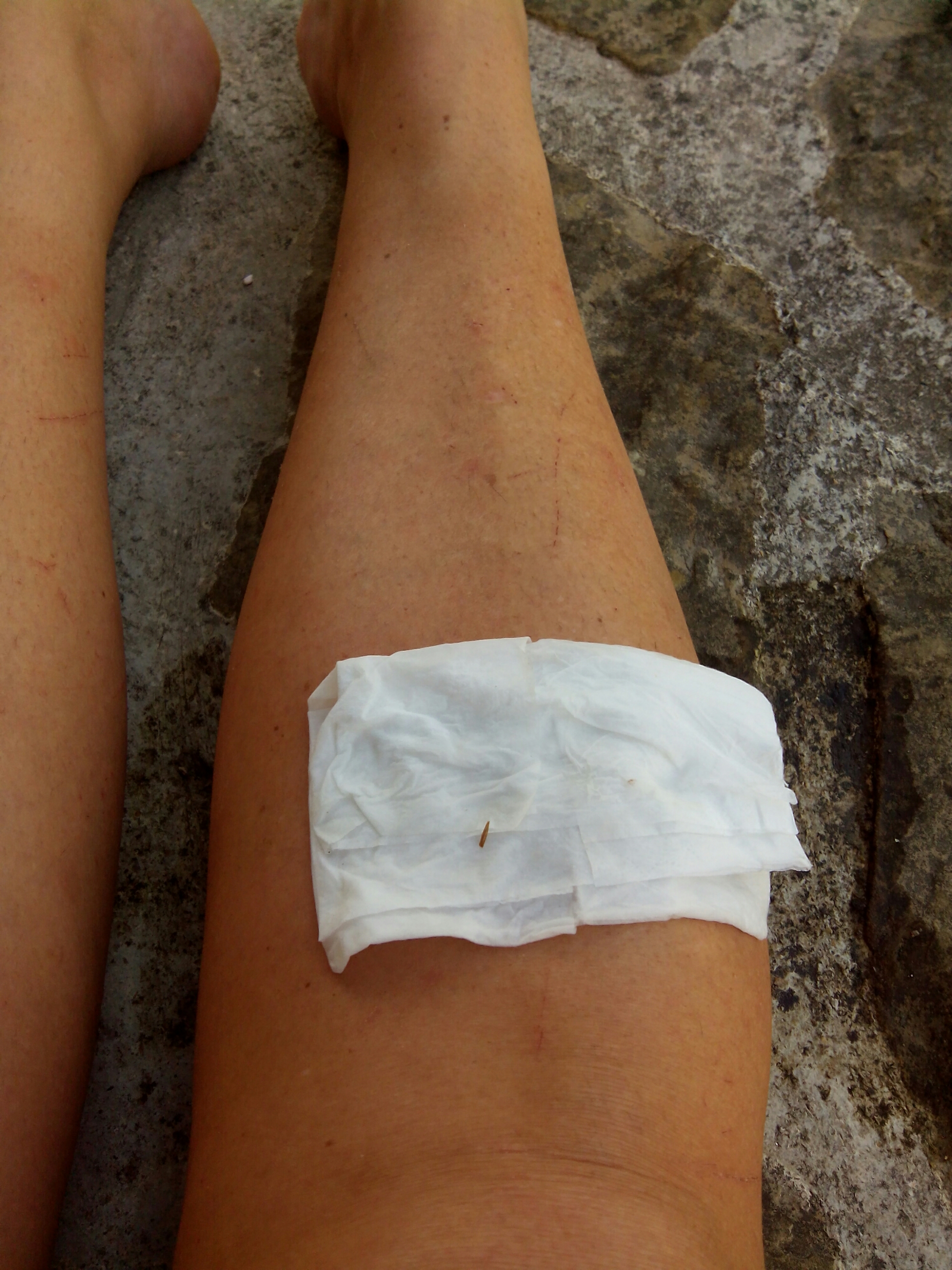 wp-1442498836419 image